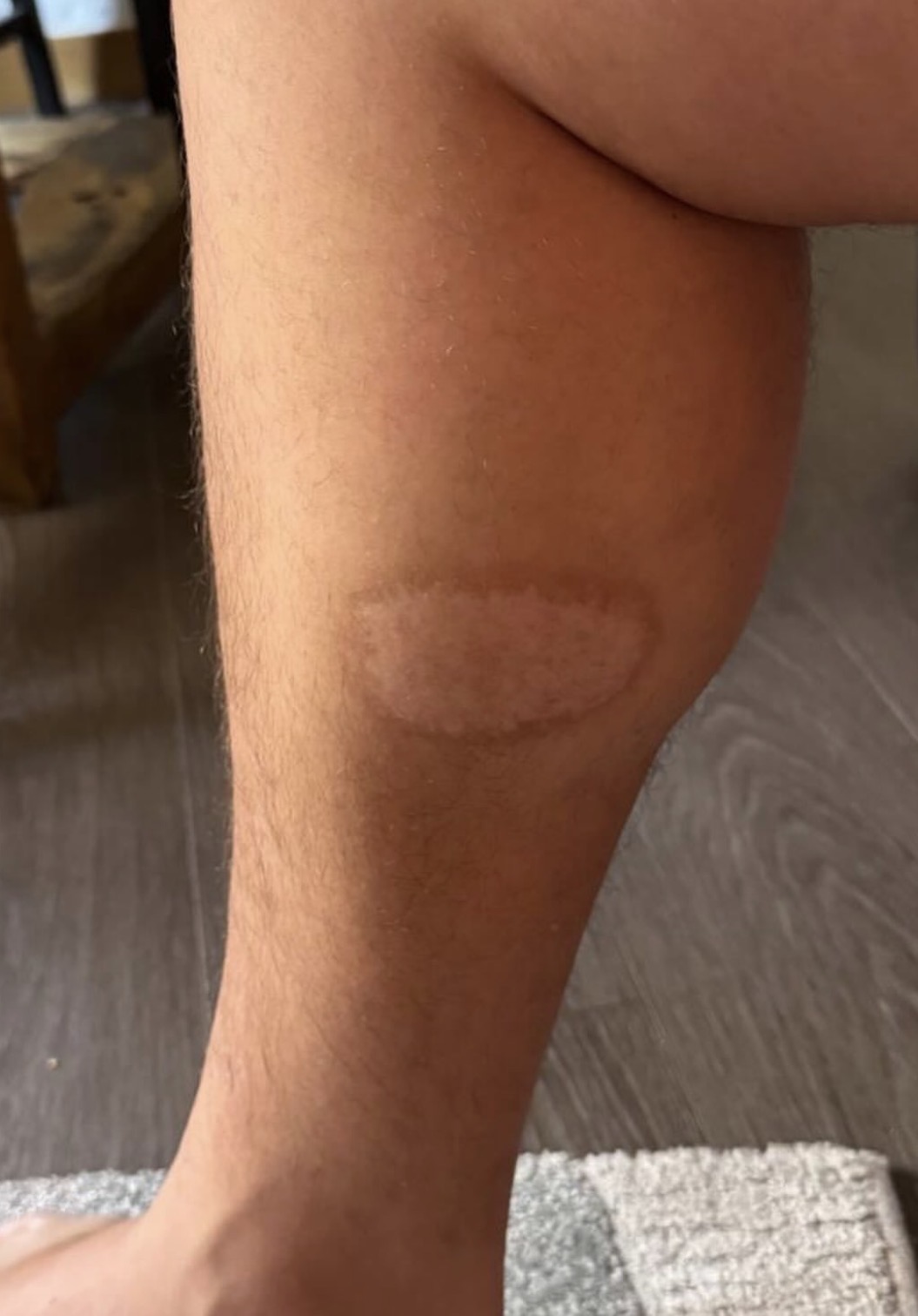 Vista 1 de 5 del tatuaje alrededor del gemelo